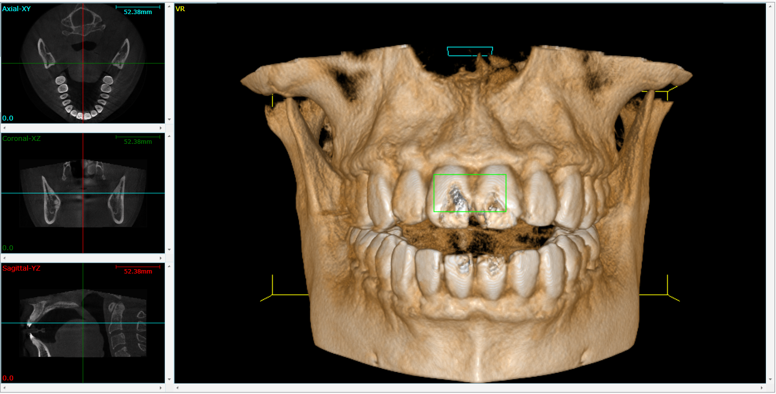 Cone Beam 3D Imaging West Covina, CA 